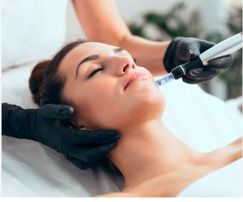 radiofrequenz microneedling wien